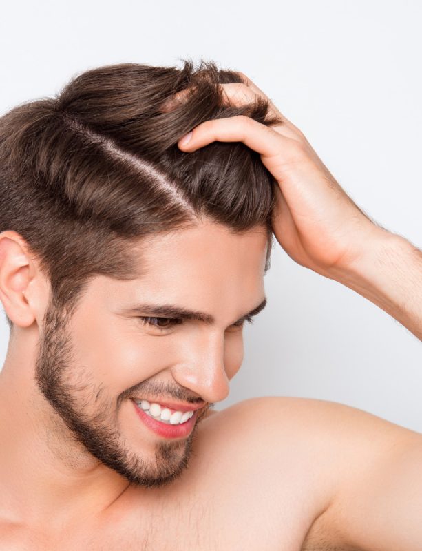 greffe-de-cheveux-Nice