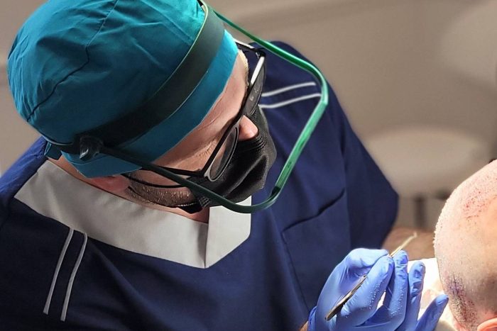 nouvelle-technique-de-greffe-de-cheveux-à-Nice