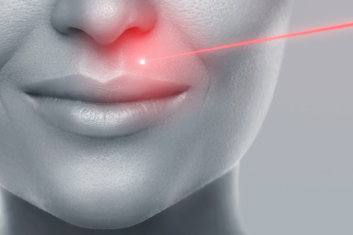 Concept of laser hair removal or skin rejuvenation