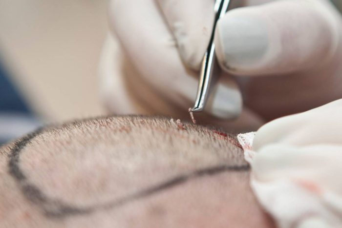 quelle-technique-choisir